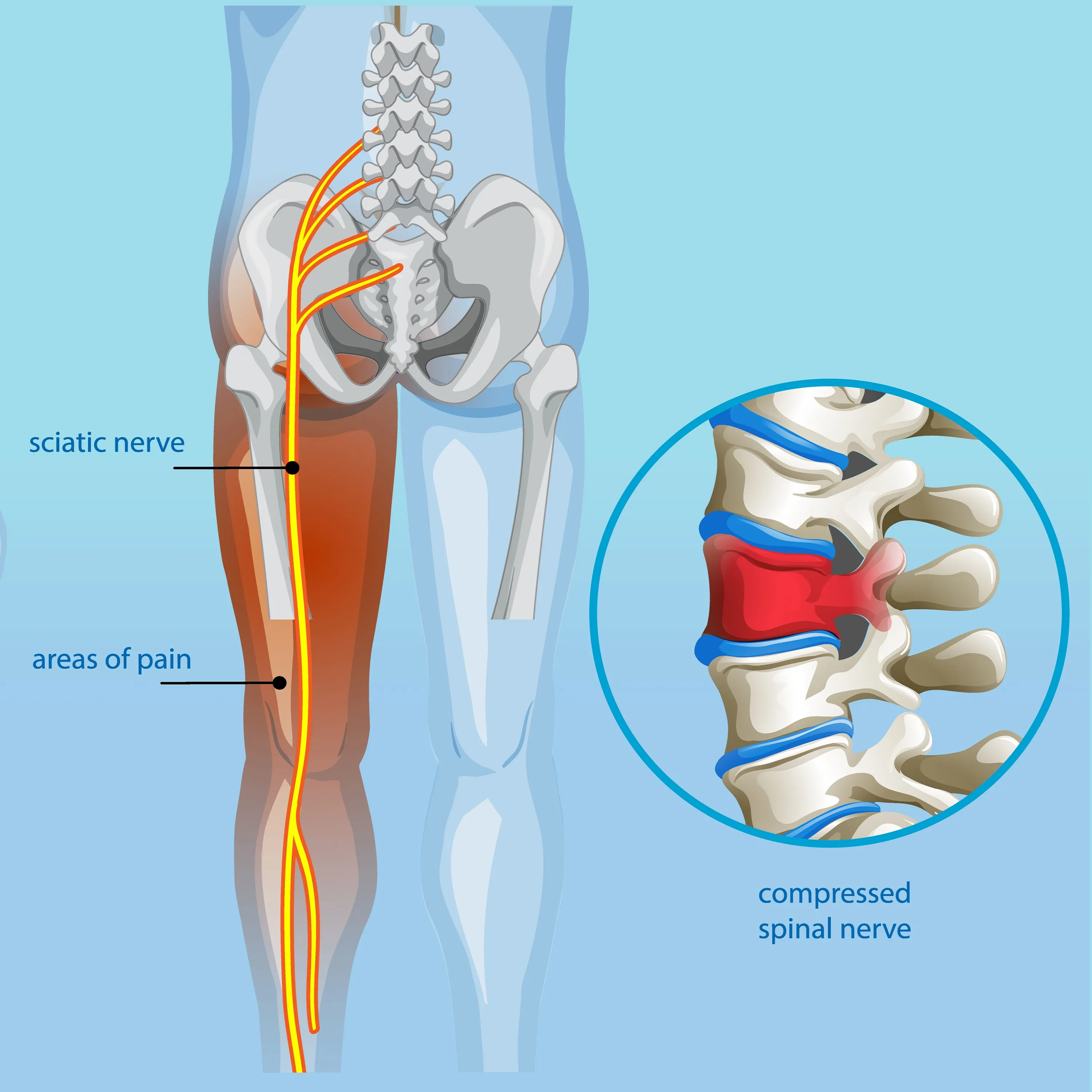 Best Sciatica Doctor in Arang